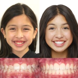 before and after 2