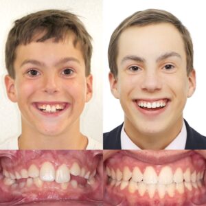 before and after 3