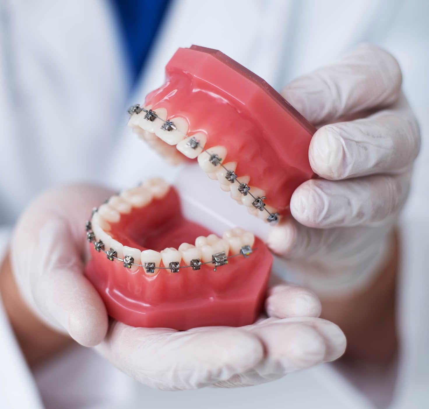 a doctor holding a model of braces in his hands